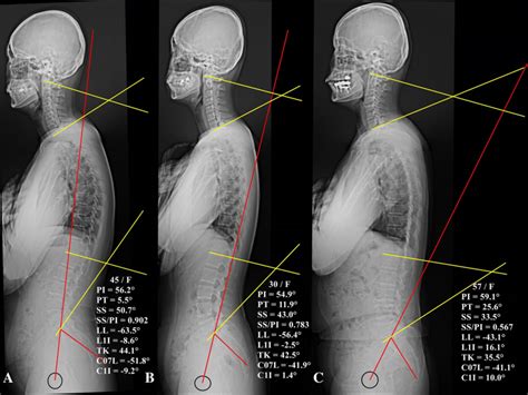 Schematic Drawings Of Characteristics Of Different Alignment Pattern By