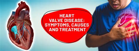 Heart Valve Disease Symptoms Causes And Treatment Hearty Tips