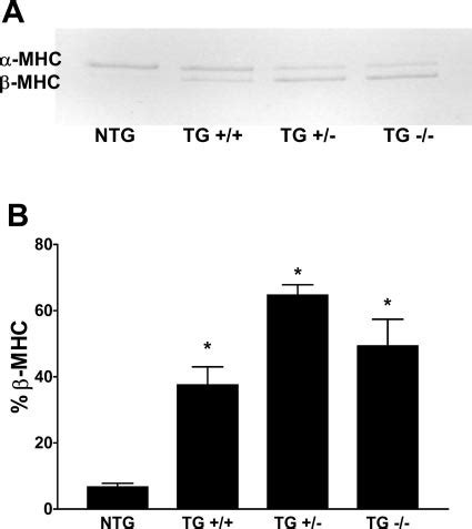 Relative Amount Of Myosin Heavy Chain MHC Present In Hearts From NTG