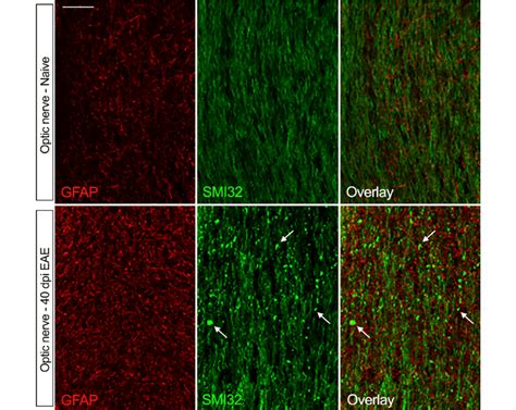 Astroglial Reactivity And Axonal Damage In The Mouse Optic Nerve At The