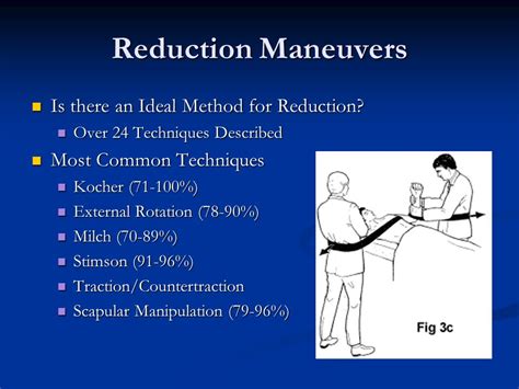 Kocher Maneuver Shoulder