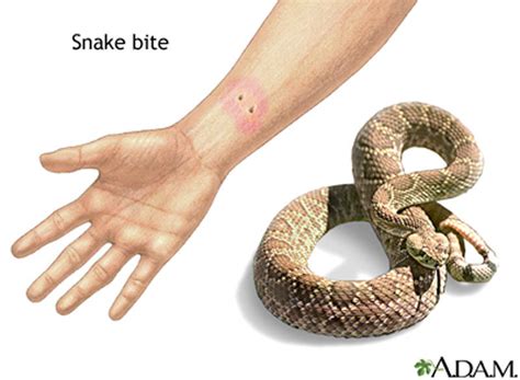 Snake Bite While Adventuring in Southern Idaho - What to do Guide ...