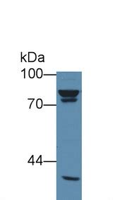 PathPlus Vimentin Monoclonal Antibody Mouse Anti Human IHC WB LSBio