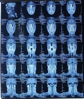 Endoscopy examination | Download Scientific Diagram