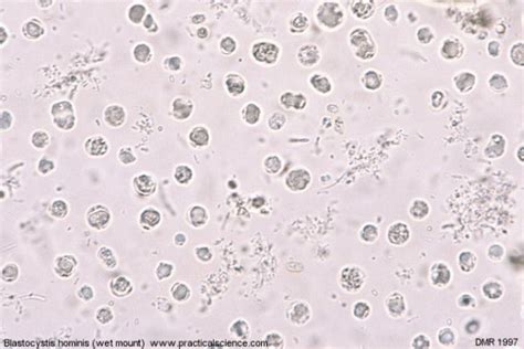 Blastocystis Hominis Medical Laboratories