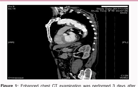 Figure From A Case Of Successful Multi Stage Open Surgical Conversion