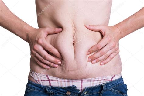 Abdominal Surface Of Fat Woman Stock Photo By 8r1n31k2010 117008510