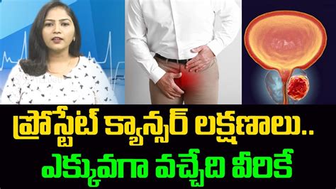 Prostate Cancer Symptoms How To Cure Prostate Cancer ప్రోస్టేట్ క్యాన్సర్ 99tv Youtube