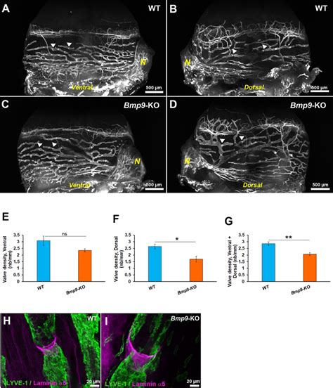 Comparative Analysis Of Valves In Conjunctival Lymphatic Vessels In