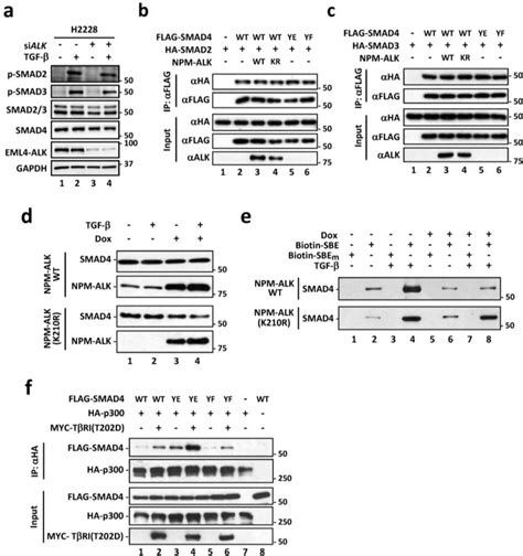 ALK Blocks The DNA Binding Activity Of SMAD4 But Not Its Nuclear