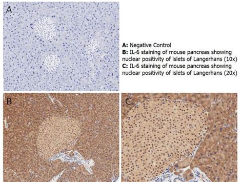 Anti-IL6 / Interleukin 6 Antibody | Rabbit anti-Mouse Polyclonal | LSBio