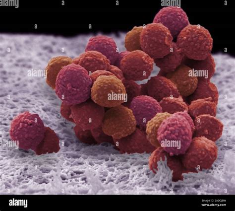 Staphylococcus Epidermidis Bacteria Coloured Scanning Electron