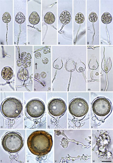 Morphological Structures Of Phytophthora Tonkinensis A N Sporangia