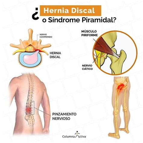 Pin Em Columna Activa