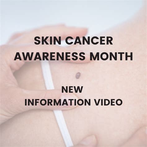 Skin Cancer Awareness Month New Information Video The City Of Dublin