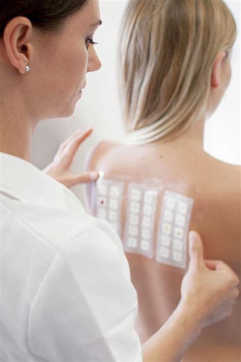 Patient Undergoing A Patch Test In Allergy Clinic Photograph By Science