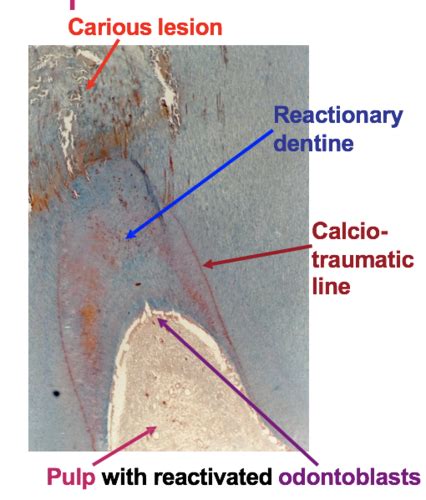 Dentine And Pulp Flashcards Quizlet