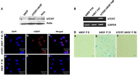 Immortalization Of Human Gingival Fibroblasts And Confirmation A