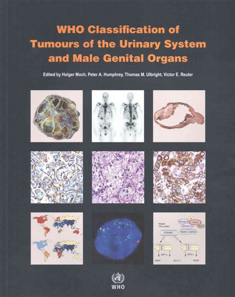 Buy Who Classification Of Tumours Of The Urinary System And Male