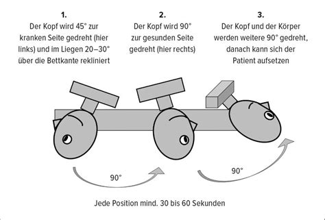 Benigner Paroxysmaler Lagerungsschwindel Viele Theorien Hno