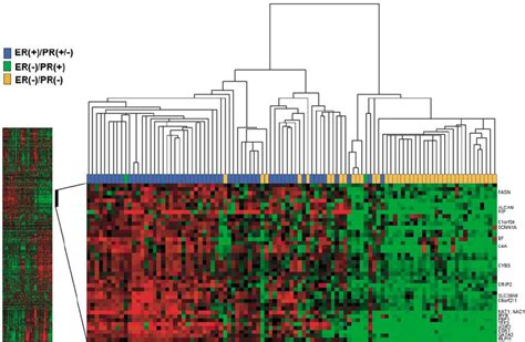 Molecular Heterogeneity Of Breast Cancers Two Way Hierarchical