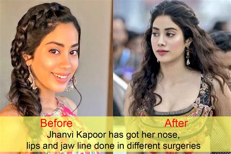 10 Bollywood Celebs Who Went Too Far With Plastic Surgeries