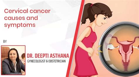 Cervical Cancer Causes And Symptoms Dr Deepti Asthana