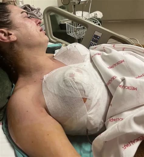 Woman Compared Her Turkey Boob Job To Being In A Slaughterhouse