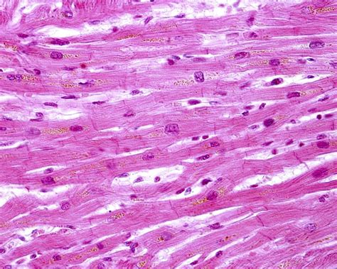 Tecido Conjuntivo Que Recobre As Fibras Musculares - 6