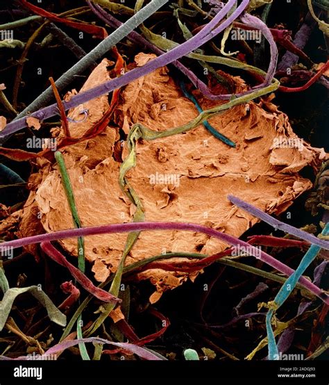 False Colour Scanning Electron Micrograph SEM Of A Piece Of Human