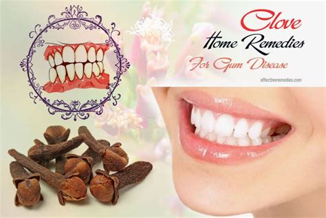 12 Common Home Remedies For Gum Disease That Work Naturally