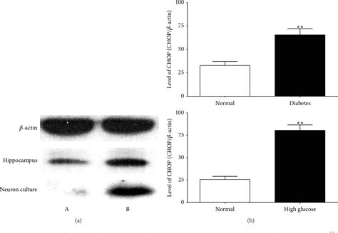 Pdf Endoplasmic Reticulum Stress Mediated Hippocampal Neuron