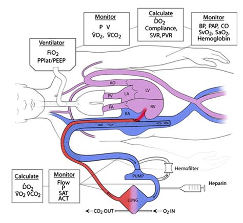 Manuali Di Medicina Intensiva Ecmo Ed Accessi Vascolari Capitolo