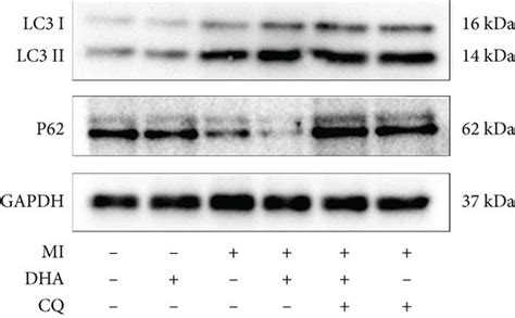 Dha Enhanced Autophagic Flux In Post Ami Mice A Western Blotting