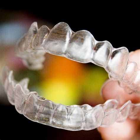 Reveal Clear Aligners Eugene Or Orthodontics Clear Braces