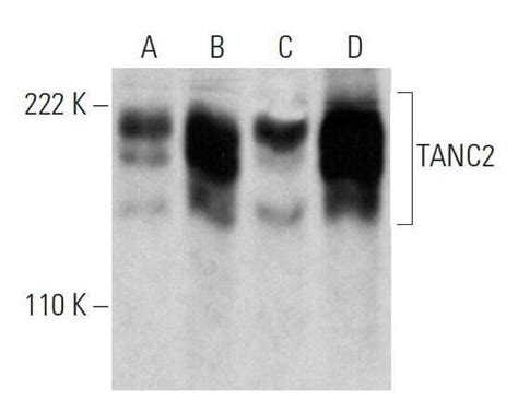 TANC2抗体 D 11 SCBT Santa Cruz Biotechnology