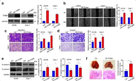 Itgb4 Promotes Migration Invasion Metastasis And Emt Process Of Ccrcc Download Scientific