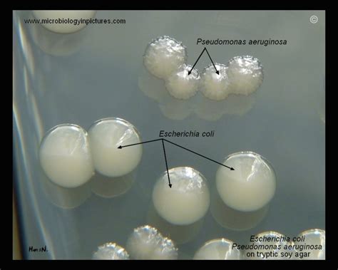 E Coli Plate Morphology