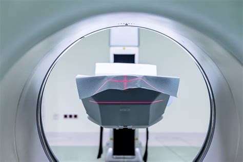 HD wallpaper: brain, scan, mri, demyelinating, medical, doctors
