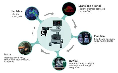 BipSee Biopsia Prostatica Con Imaging Multimodale Tema Sinergie