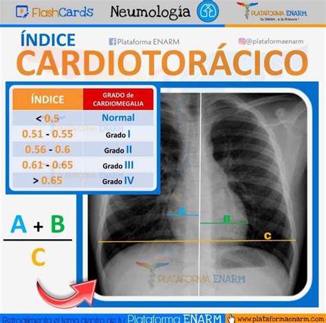 An X Ray Image Shows The Chest And Chest With Information About Cardiotia