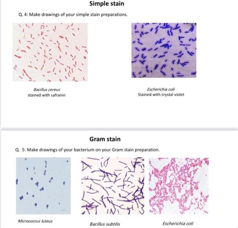 Solved Simple Stain Q Make Drawings Of Your Simple Stain Chegg