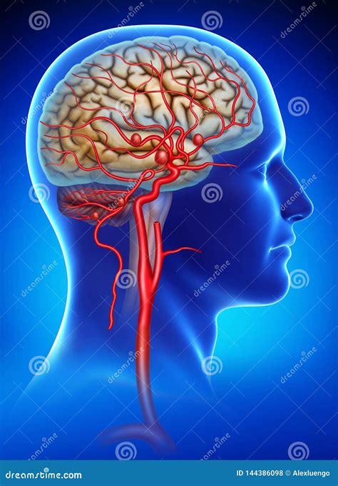 Schematic And Descriptive Illustration Of The Aneurysm In The Human