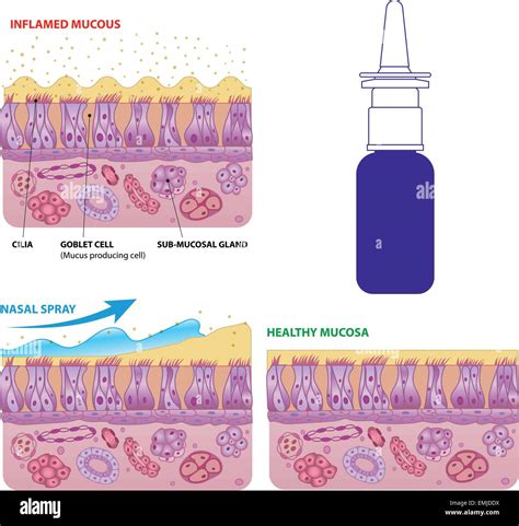 Inflamed and normal nasal mucosa cells and micro cilia vector scheme ...