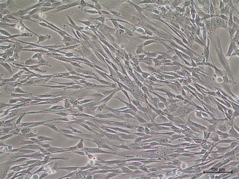 Morphological Observation Of HUCMSCs 100 The Adherent Cells