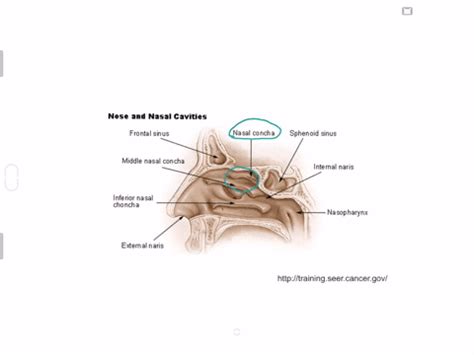 SOLVED:Which bony projections increase nasal cavity surface area? a. nares b. septae c. conchae ...