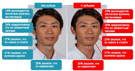Рубцы постакне: лечение рубцов после акне - Premium Aesthetics