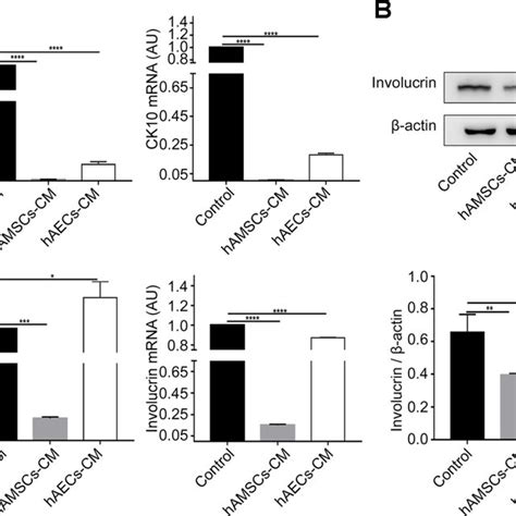 Characterization Of Hamscs Human Amniotic Mesenchymal Stem Cells And