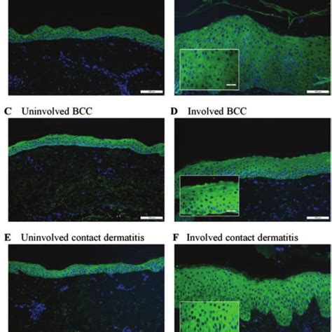 Immuno Fluorescence Staining With Localisation Of In