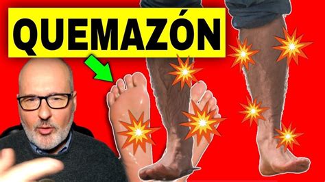 10 CAUSAS De ARDOR En PIERNAS Y PIES YouTube